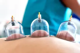 Ginkgo Health Clinic: Best Cupping Therapy London