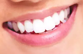 Does tooth alignment change after wisdom tooth ext