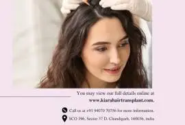 Hair transplant for women