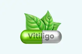 Best Vitiligo Treatment in Delhi - Kayakalp Global