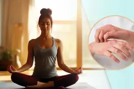 How Yoga Can Help in Psoriasis Treatment