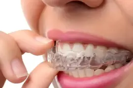 Transform Your Smile with Invisalign in Seattle at